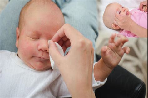 bebeğin gözündeki çapak nasıl temizlenir